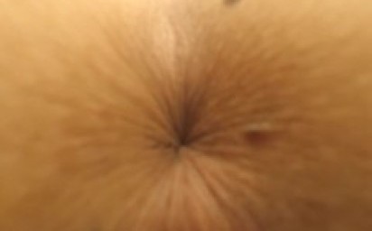 Girl shrinks her ANAL hole! Ass close-up!!